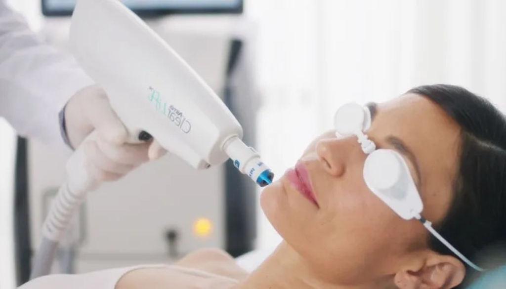 clearlift laser