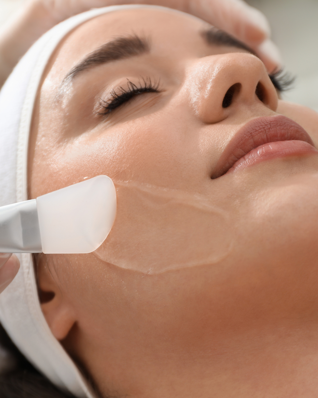 benefits of a chemical peel